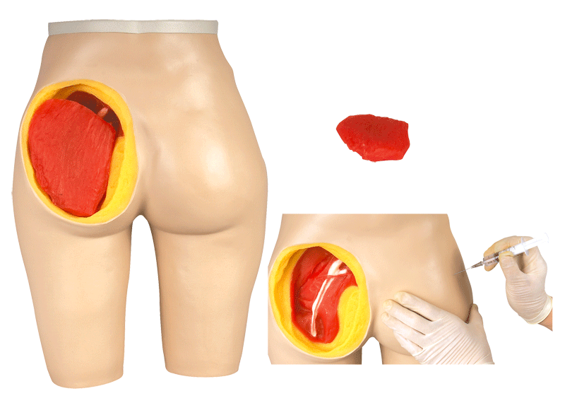 臀部肌肉注射与解剖结构模型