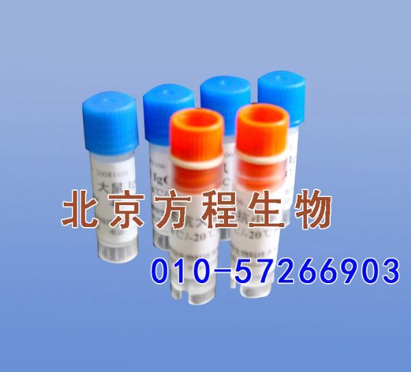方程生物试剂图片 (3).jpg 人尿激酶型纤溶酶原激活因子受体(uPAR)检测/(ELISA)kit试剂盒/免费检测