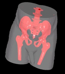 3D-DOCTOR | 三维图像处理软件